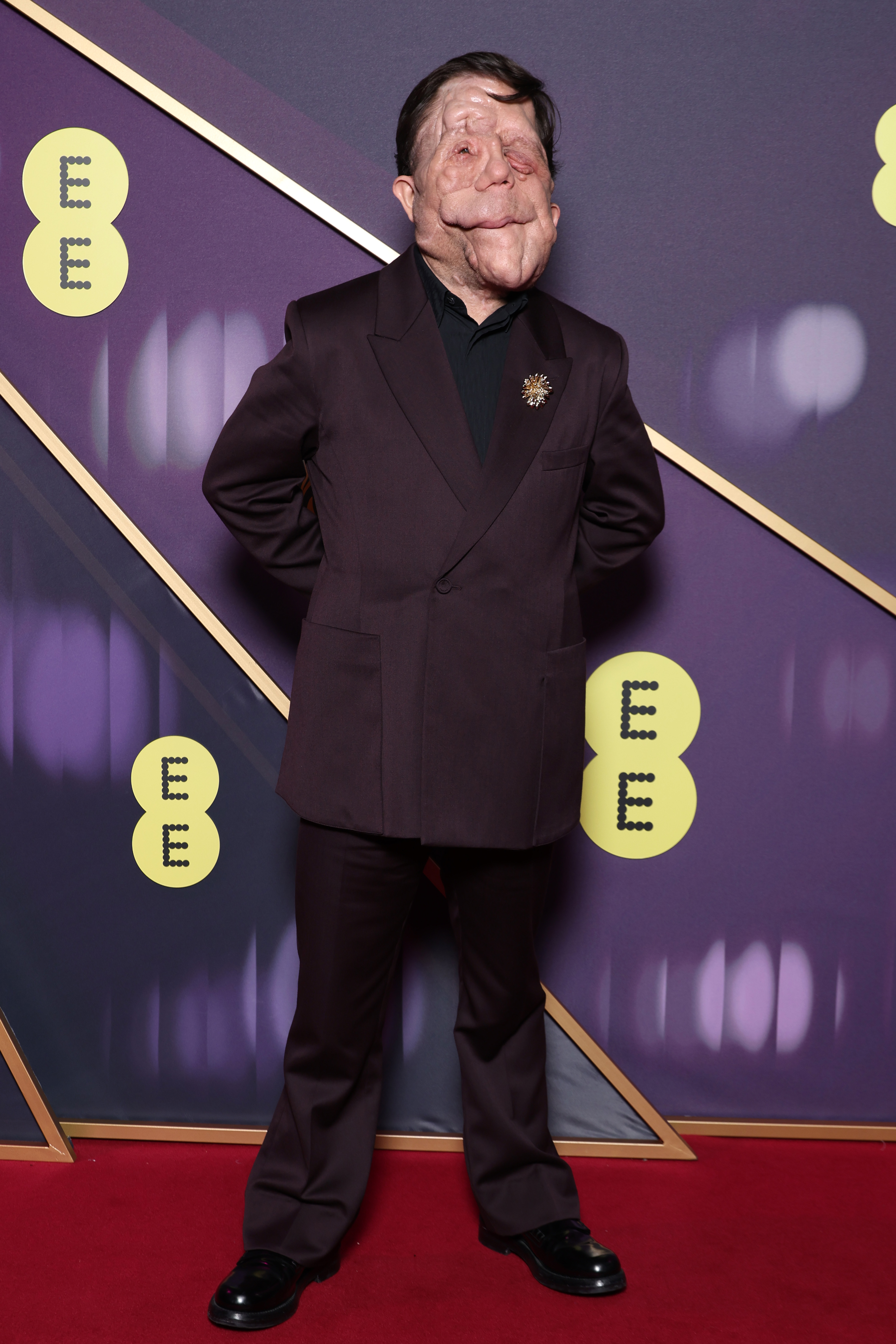 LONDON, ENGLAND - FEBRUARY 16: Adam Pearson attends the EE BAFTA Film Awards 2025 at The Royal Festival Hall on February 16, 2025 in London, England. (Photo by Pascal Le Segretain/Getty Images)